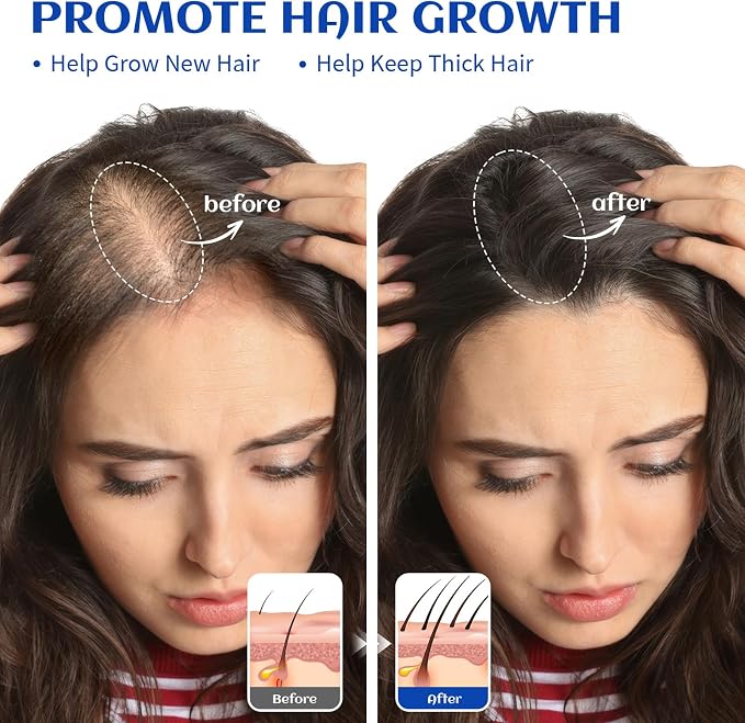 HIQILI 1000ML Rosemary Oil for Hair Growth, Add to Shampoo & Conditioner - 32 Fl Oz